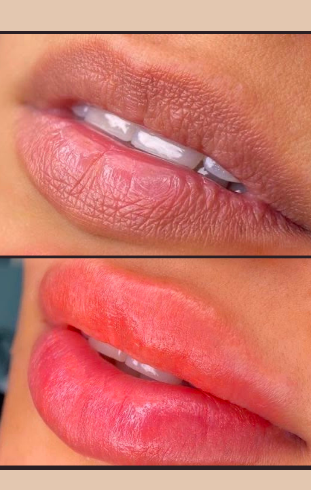 Lip blush natural color result